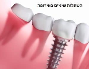 למה כדי לבצע השתלות שיניים באירופה